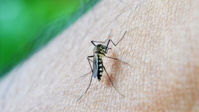 Demam berdarah dengue, atau DBD, merupakan suatu penyakit yang disebabkan oleh virus dengue dan ditularkan melalui gigitan dari nyamuk Aedes aegypti. Para penderita DBD seringkali merasakan nyeri yang sangat hebat, terutama di area tulang dan sendi, sehingga menimbulkan sensasi seperti patah tulang.