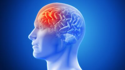 Stroke adalah kondisi medis serius yang mengancam jiwa akibat gangguan aliran darah ke otak, dengan dua jenis utama: Stroke Iskemik dan Stroke Hemoragik. Gejala stroke muncul tiba-tiba dan memerlukan penanganan cepat untuk mengurangi kerusakan otak. Dr. Nilamsari dari Bethsaida Hospital Serang menjelaskan pentingnya mengenali tanda-tanda stroke dan mendapatkan bantuan medis segera, terutama dalam periode Golden Hour. Dengan pusat layanan unggulan stroke dan rehabilitasi, Bethsaida Hospital berkomitmen untuk memulihkan kualitas hidup pasien stroke secara optimal.