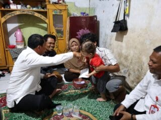 Bupati Tangerang kunjungi balita penderita tumor di Kronjo, pastikan penanganan lanjutan dan dukungan penuh dari Pemkab.