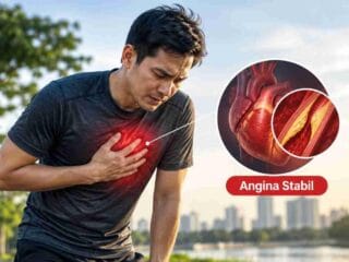 Nyeri Dada Saat Berolahraga Jangan Diabaikan, Bisa Jadi Tanda Angina Stabil